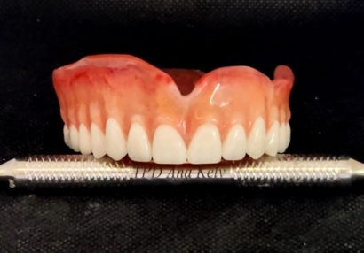 Próteses Dentárias